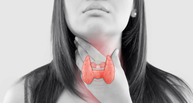 Avoid food from thyroid problems, diet Hypothyroidism